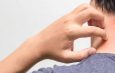 Riwayat Penyakit Kulit Masih Menjadi Masalah Umum Pada ODHIV