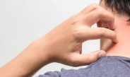 Riwayat Penyakit Kulit Masih Menjadi Masalah Umum Pada ODHIV