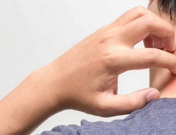 Riwayat Penyakit Kulit Masih Menjadi Masalah Umum Pada ODHIV