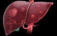 Adherence to Hepatocelullar Carcinoma Surveillance Guidelines