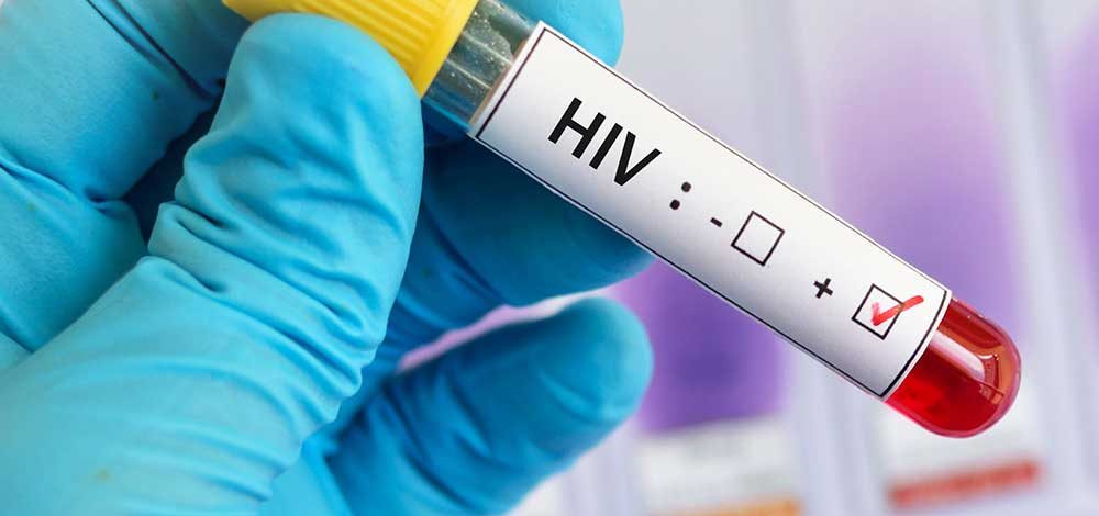 Antibodi Penetral: Perkembangan Pengobatan HIV