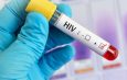 Antibodi Penetral: Perkembangan Pengobatan HIV