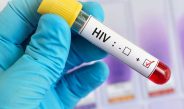 Antibodi Penetral: Perkembangan Pengobatan HIV