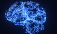 Patterns of Brain-wide Associations Reflect Socioeconomics