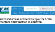 Stres dan Kurang Tidur Merubah Struktur dan Fungsi Otak